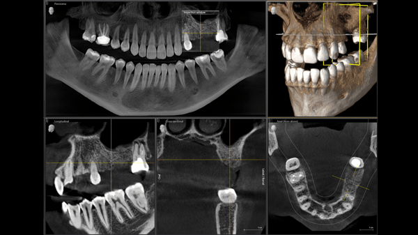 3d dental imaging