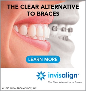 invisalign braces clear angle aligners orthodontics take dental getting tips most teeth care