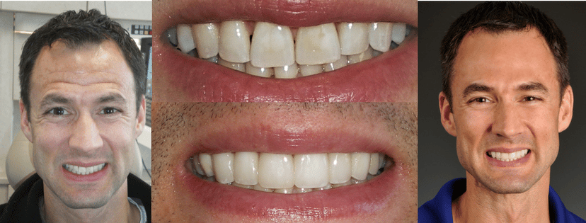 Smile Gallery | William Linger, DDS, MAGD