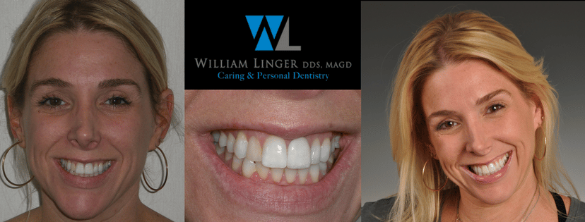 Smile Gallery | William Linger, DDS, MAGD