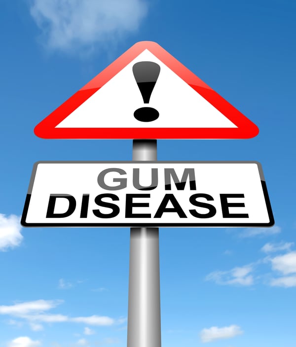 gum inflammation