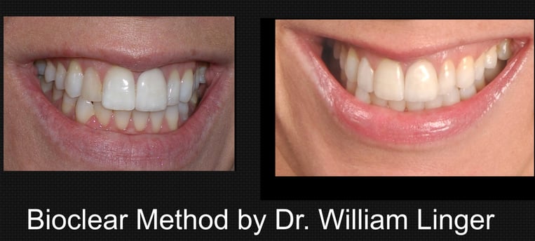 Bioclear Method by Dr. Linger, Charlotte, NC