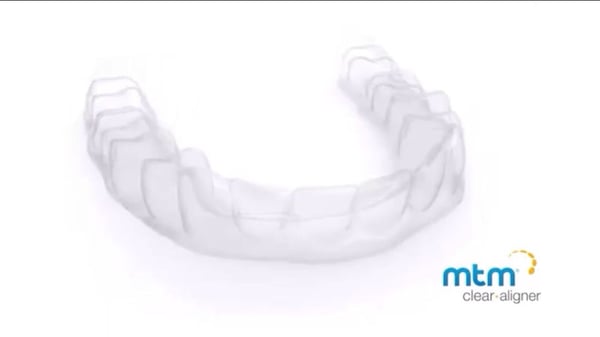 mtm clear aligner