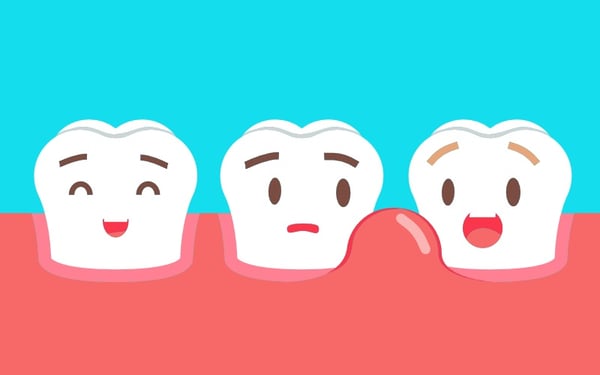 symptoms of gum disease