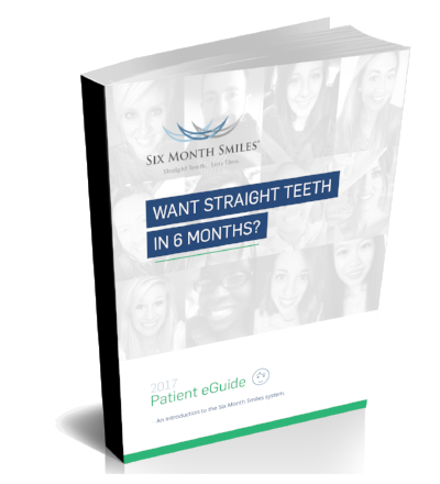 six month smile guide